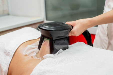 Woman getting cryolipolysis fat treatment procedure in professional cosmetic cabinet or spa centerの写真素材