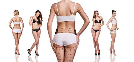 Woman's buttocks prepared to plastic surgery isolated Woman's buttocks prepared to plastic surgery isolated