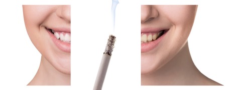 Smile before and after smoking. Concept of healthy smileの写真素材