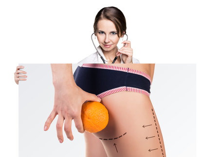 Female doctor holds placard with woman battocks and correction lines on them. Plastic surgery concept.の写真素材