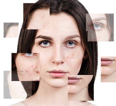 Square parts shows before skin problems.の写真素材
