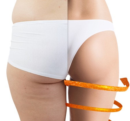 Big spiral arrows shows result of slimming. Female buttocks before and after sport.の写真素材