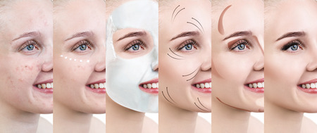 Woman step by step improves her skin condition.の写真素材