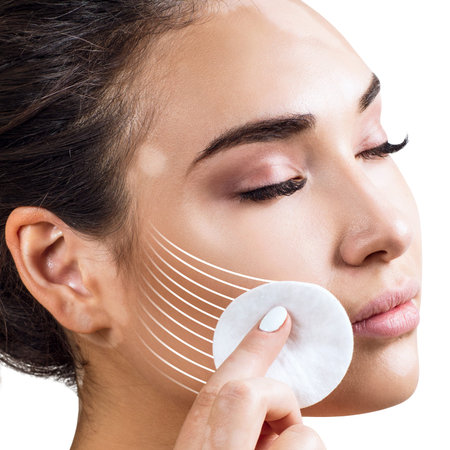 Graphic lines shows facial lifting effect on skin vith vitiligo.