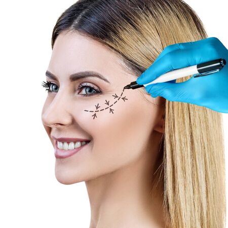 Beautiful woman face with correction lines for plastic surgery.の写真素材