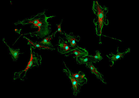 Microfilaments (green), mitochondria (red), and nuclei (blue) in fibroblast cells