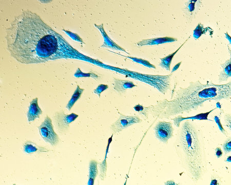 PC-3 human prostate cancer cells, stained with Coomassie blue, under differencial interference...