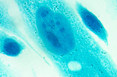 PC-3 human prostate cancer cells, stained with Coomassie blue, under differencial interference...