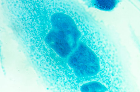 PC-3 human prostate cancer cells, stained with Coomassie blue, under differencial interference...