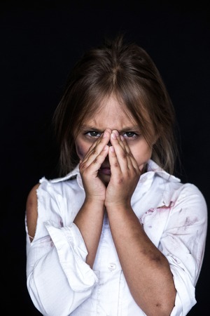 Child abuse. Sad and lonely girl crying . Injured child posing as victim of domestic violenceの写真素材