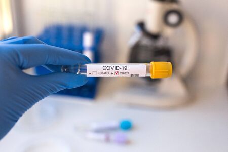 COVID-19 coronavirus positive blood sample diagnosed in hospital. Coronovirus testの写真素材