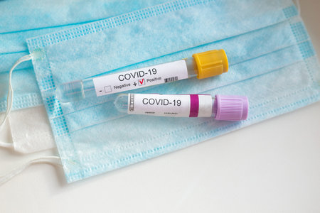 Coronavirus test and protective mask on white background
