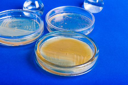 Cultivation of bacteria  Streptococcus  on  agar の写真素材