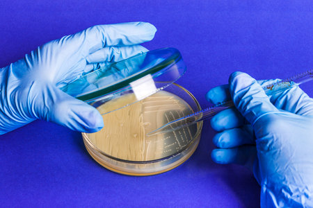 Hand in glove holding the petri dish with bacteria Streptococcus A の写真素材