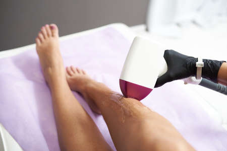 beautician removes hair on beautiful female legs using a laser. hair removal on the legs, laser procedure at clinicの写真素材