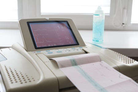 Printing of cardiogram report coming out from Electrocardiograph in labour ward. Fetal monitorの写真素材