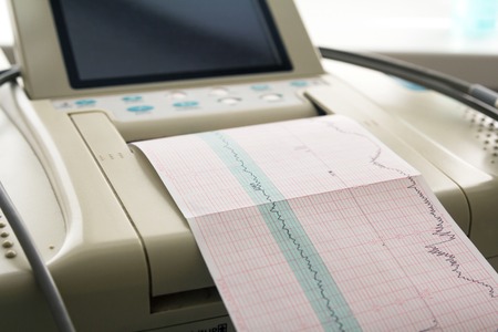 Printing of cardiogram report coming out from Electrocardiograph in labour ward. Fetal monitorの写真素材