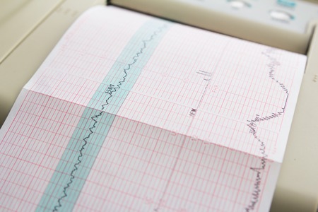 Printing of cardiogram report coming out from Electrocardiograph in labour ward. Fetal monitorの写真素材