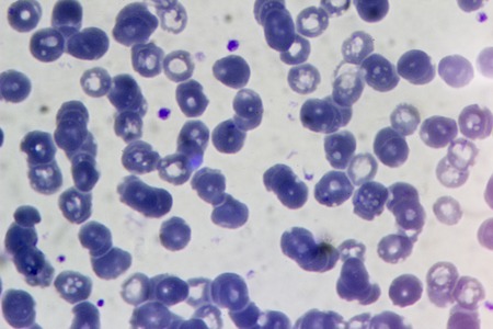 Blood analysis under a microscope, close-up, medicalの写真素材
