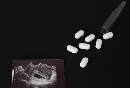 Uzi shot, pills and test tube on a black background, abortion, close-upの写真素材