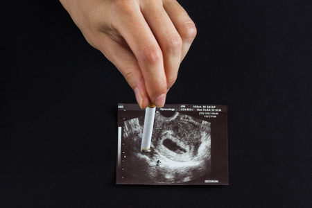 A woman's hand, a future mother extinguishes a cigarette on a picture of a pregnancy uzi, pregnancy and smoking, gestation cigaretteの写真素材