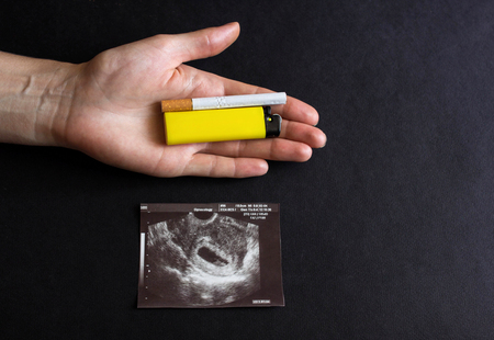 The future mother holds a cigarette and a lighter in her hand, next to a photograph of the pregnancy uzi, pregnancy and smoking, childbearing gestationの写真素材
