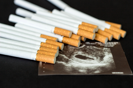 Cigarettes in the picture of pregnancy, pregnancy and smoking, gestation, cigaretteの写真素材