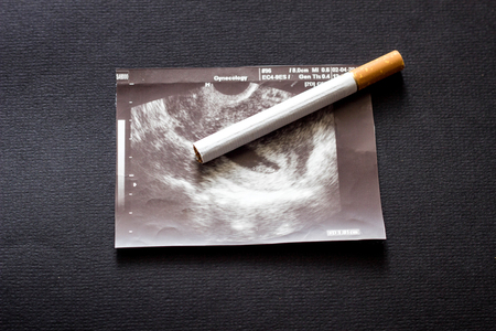 Cigarette on the picture of uzi pregnancy, pregnancy and smoking, gestationの写真素材