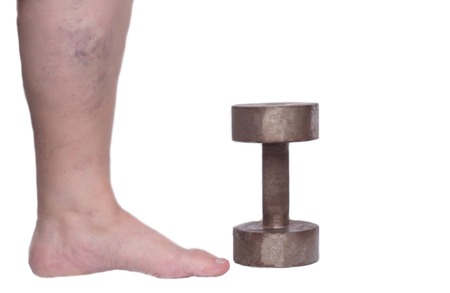 Leg of an elderly woman on a white background with varicose veins, near an iron dumbbell, heaviness in the legs, the concept of varicose veins in the legs, phlebeurysm, metalの写真素材
