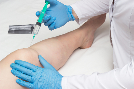 The doctor introduces the patient to an arthritic knee chondroprotector and the preparation of hilauri acid to restore the knee joint and synovial fluid, intraarticular injection, orthopedistの写真素材