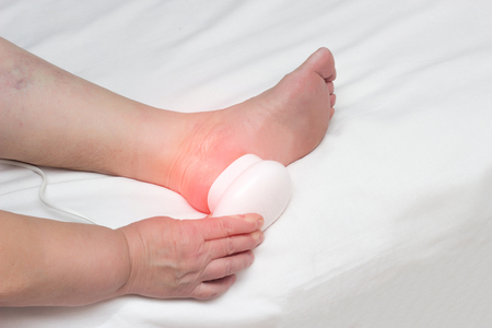 Treatment of heel spurs using physiotherapy, medical magnet, technology, close-up, copy space, anti-inflammatory, variableの写真素材
