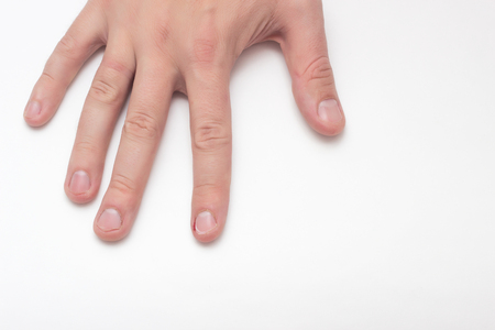 A hand on a white background whose nails are bitten and torn, a bad habit, close-up, copy space, medicine, fingernail, backgroundの写真素材