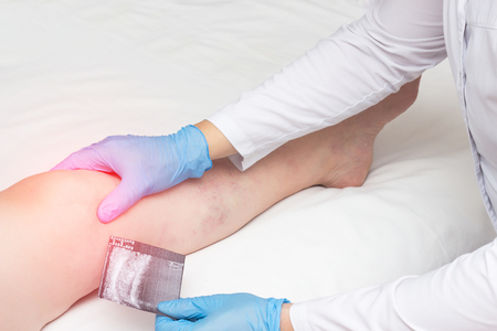 The orthopedist holds a picture of an ultrasound and examines a woman s knee, diagnoses arthrosis and arthritis, copys space, inflammation, synovitisの写真素材