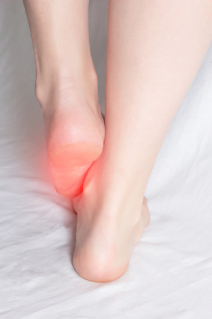 Female legs on a white background that are infected with fungal infection and onychomycosis, close-up, medical, mycosisの写真素材