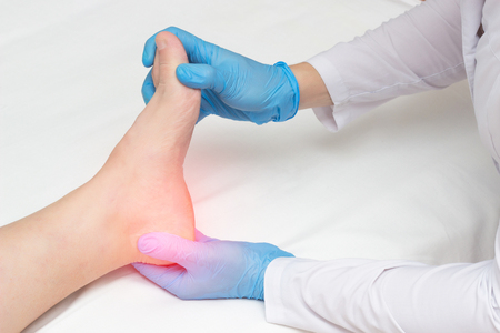Doctor examines the sore heel of a woman who has a heel spur, plantar fasciitisの写真素材