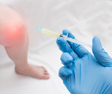 A doctor in medical gloves holds a syringe with plasma to inject a plasma into a patient with a knee that has inflammation, close-up, plasma-lifting, autoplasmotherapyの写真素材