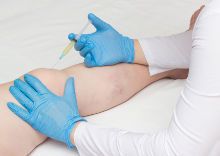 The doctor injects plasma into the knee joint of a woman to eliminate pain and symptoms of arthritis and arthrosis, relieve inflammation with a plasma-lifting method, autoplasmotherapyの写真素材