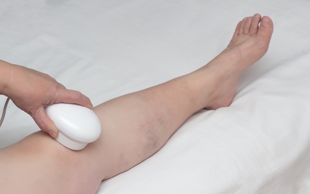 Alternative medicine, treatment of knee disease by physiotherapy with magnetic therapy, close-up, orthopedics, osteoarthritis, patientの写真素材