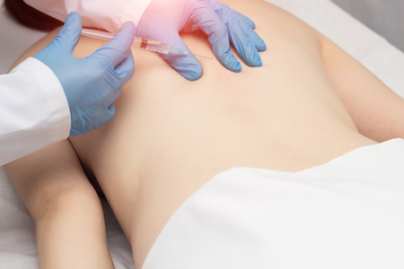 Doctor injects trigger points on the patient s back to eliminate muscle spasm and pain, anestheticの写真素材