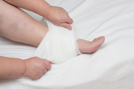 A woman sets up a warming and anti-inflammatory compress on the heel with heel spurs, plantar fasciitis, close-up, copy space, calcification, osteophyteの写真素材