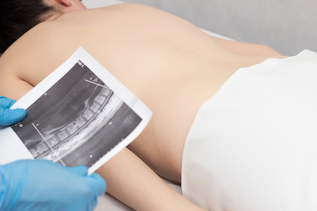 Doctor holds an MRI shot on the back of a girl who has a backache, back problems, neurologyの写真素材