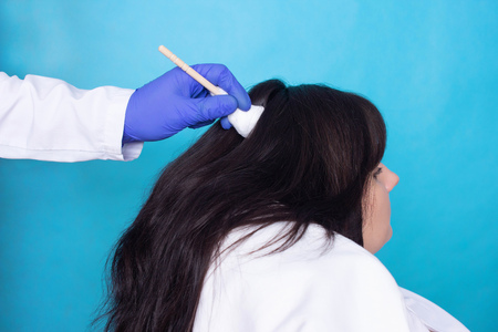The doctor with the help of liquid nitrogen cryotherapy conducts a procedure to restore the hair on the girl's head, treatment, physiotherapyの写真素材