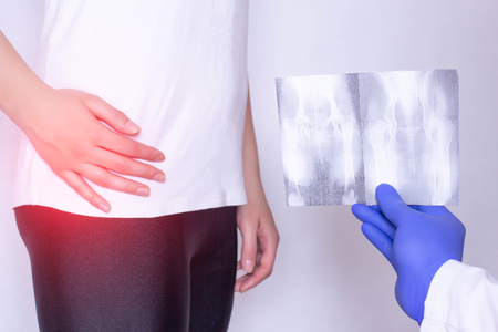 Doctor holds x-ray picture on the background of a girl with a sore hip joint and intervertebral hernia, fibromyalgia, close-up, ultrasound diagnosticsの写真素材