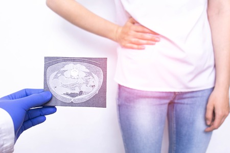 The doctor holds in his hand a snapshot of magnetic resonance imaging against the background of a...
