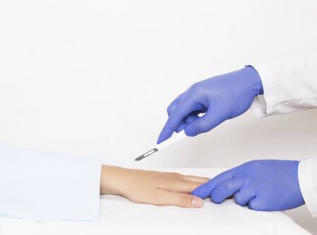 dotcore surgeon holds a scalpel near the radiocarpal joint on the girl s arm, the concept of operation and treatment of carpal tunnel syndrome and joint arthroplasty, artificial joint, pinched nerve, copy spaceの写真素材