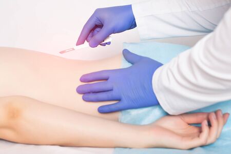 Doctor holding a surgical scalpel near the spine of the girl concept of spinal surgery diskectomy and laminectomy, spondylolisthesisの写真素材