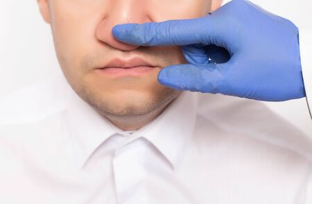A plastic surgeon examines the nose of a patient's male patient before surgery. Rhinoplasty, a modern method of plastic surgery for nose cartilage.の写真素材