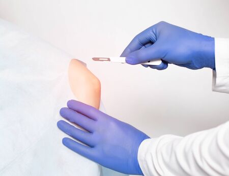 Doctor surgeon makes an incision with a scalpel on the elbow joint to replace an injured joint with an artificial joint replacement, medicalの写真素材