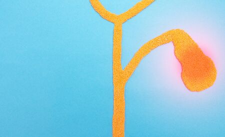 Bile ducts and gall bladder from plasticine on a blue background. Gallbladder disease concept and...