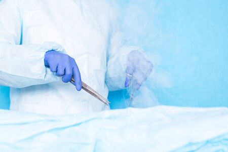 Dr. cryosurgeon performs a modern operation using liquid nitrogen, cryosurgery. Liver and hair transplant concept, copy spaceの写真素材